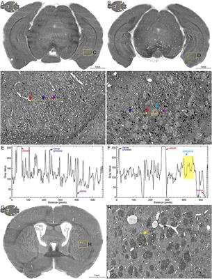 High-Resolution Digital Panorama of Multiple Structures in Whole Brain of Alzheimer's Disease Mice